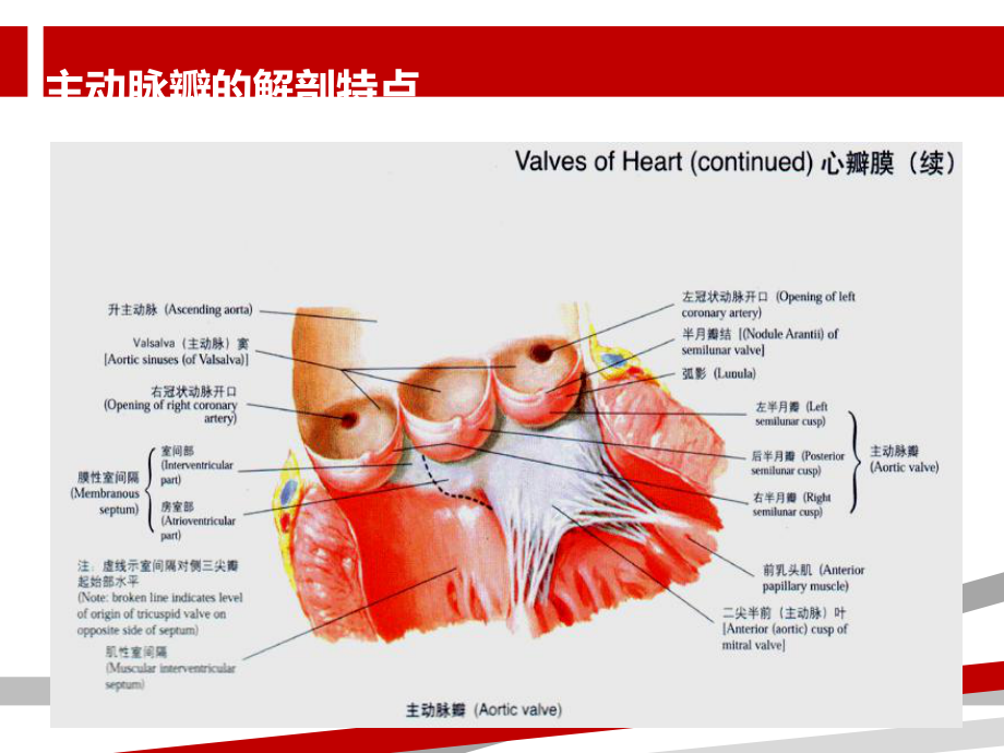 主动脉瓣疾病.ppt课件.ppt_第3页