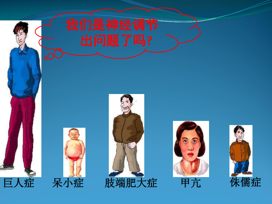 巨人症课件.ppt_第1页