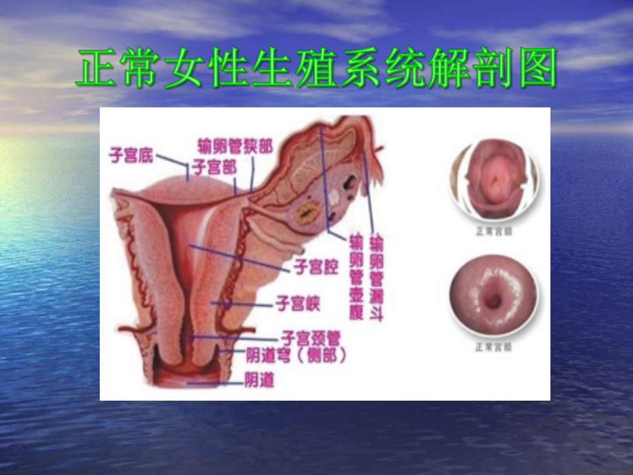 宫颈疾病预防与诊治课件.ppt_第3页