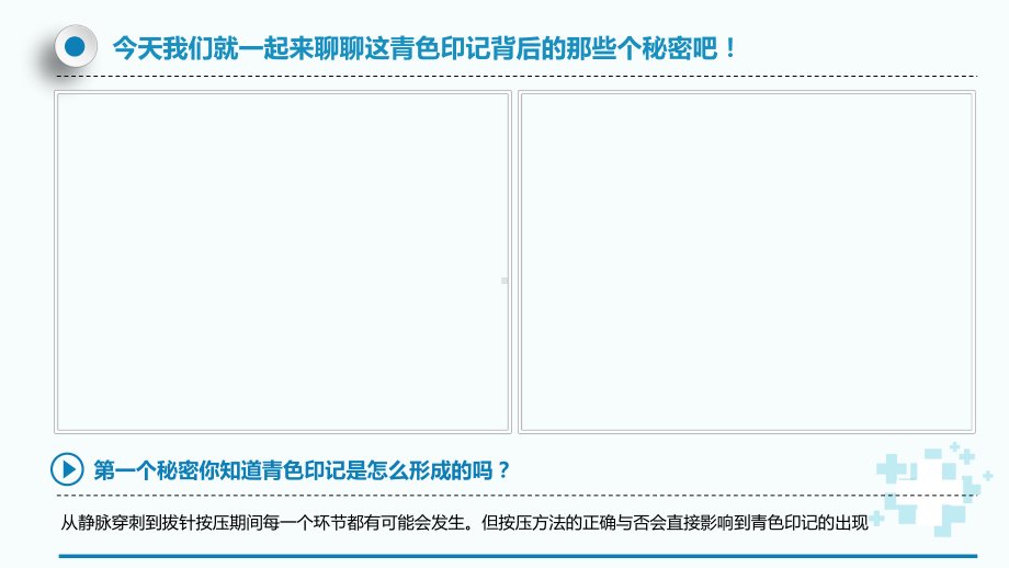 医院医疗输液后遗症护理技巧图文PPT教学课件.pptx_第3页