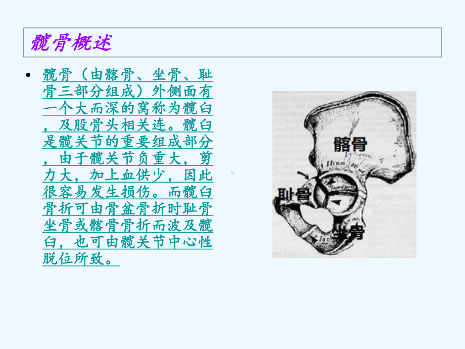 一例髋臼骨折护理查房课件.ppt_第3页