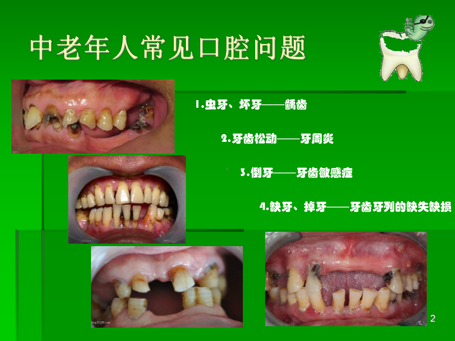 中老年人的口腔卫生保健PPT医学课件.ppt_第2页