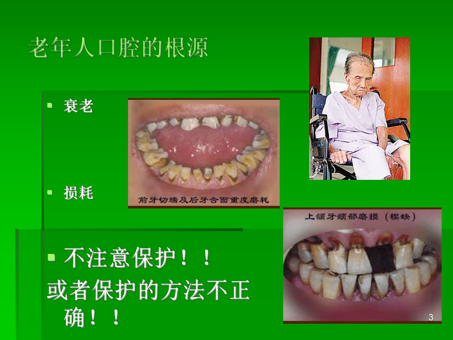 中老年人的口腔卫生保健PPT医学课件.ppt_第3页