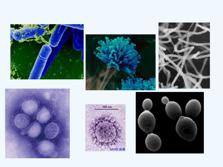 微生物与传染性疾病课件.ppt_第3页