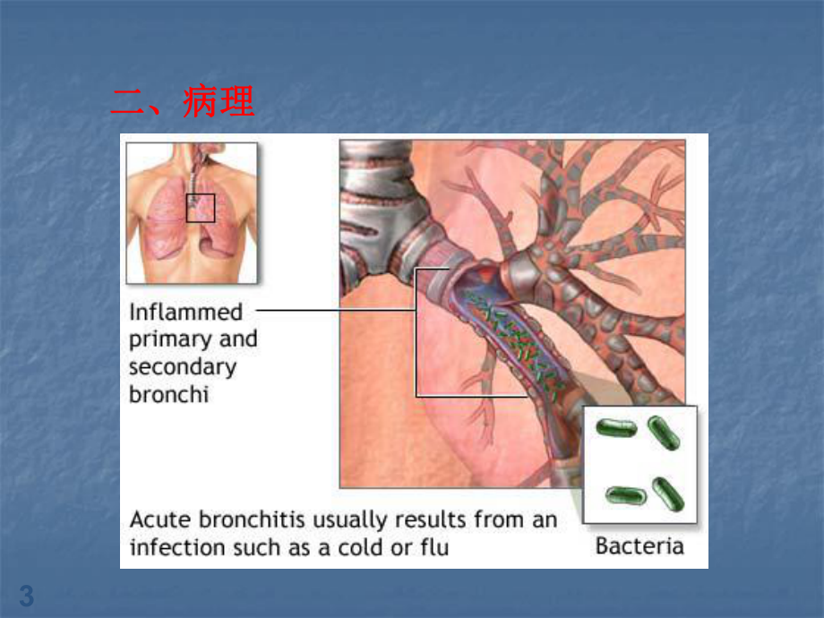 急性支气管炎ppt课件.ppt_第3页