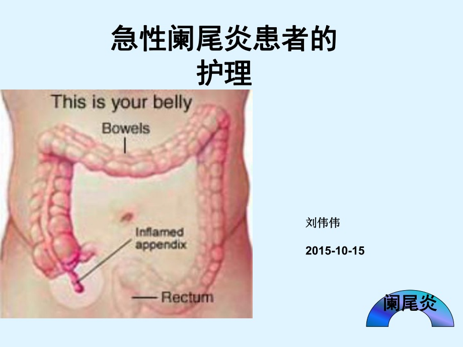 急性阑尾炎患者的护理-PPT课件.ppt_第1页