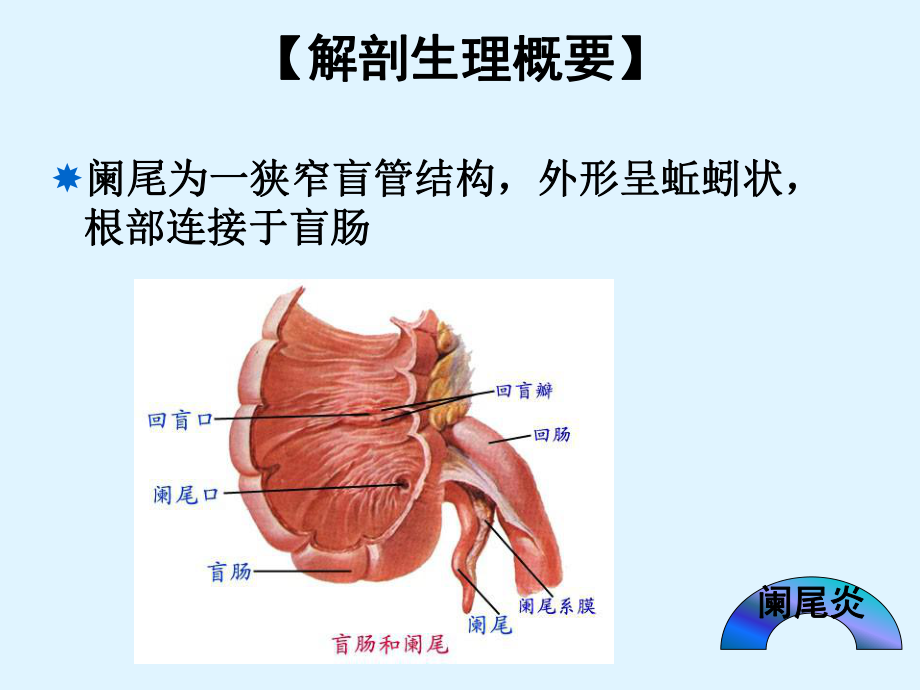 急性阑尾炎患者的护理-PPT课件.ppt_第2页