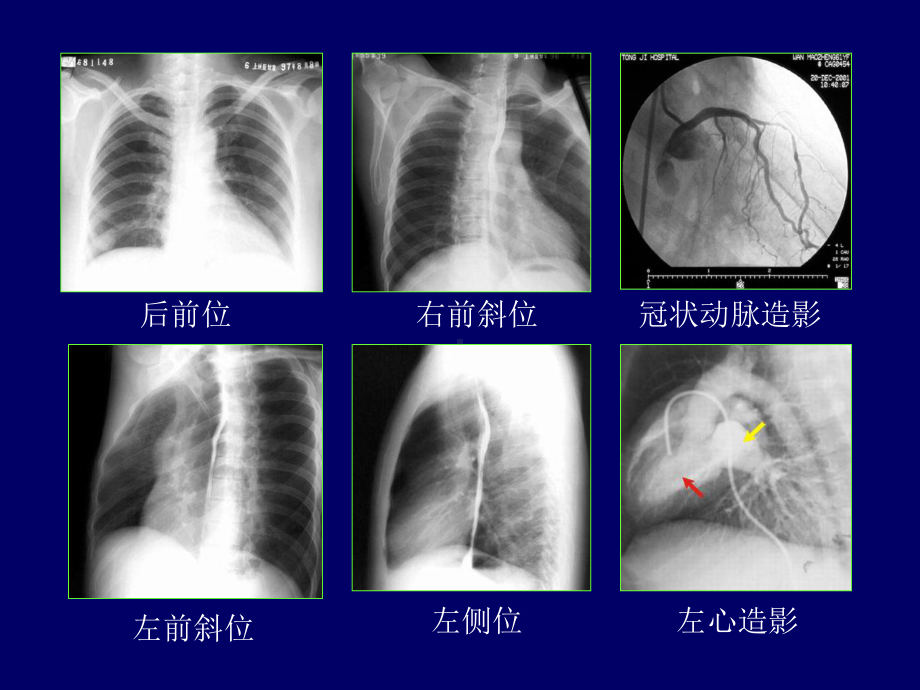 循环系统影像诊断教学课件.pptx_第3页