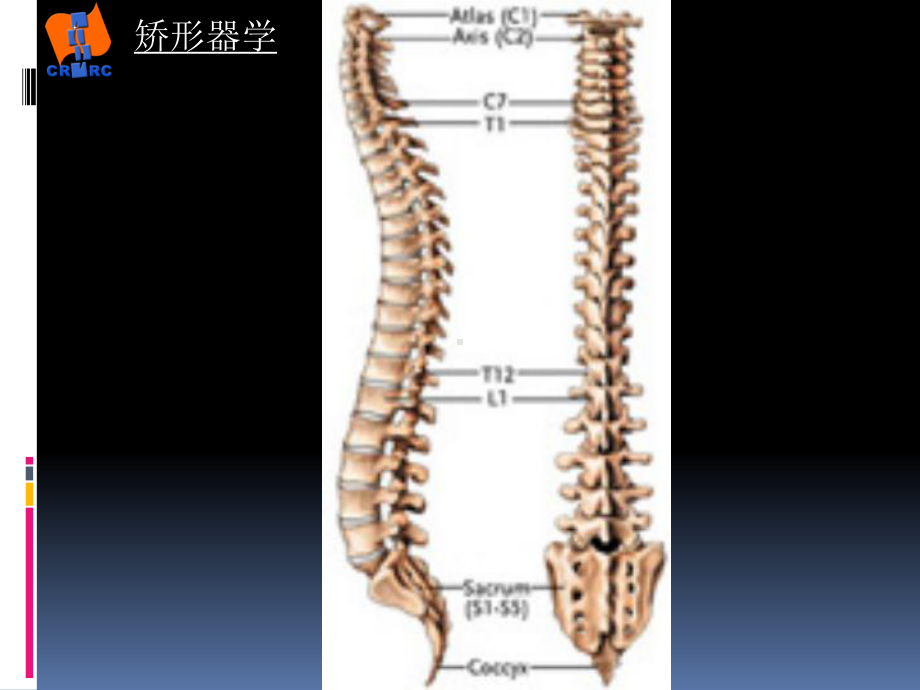 常见脊柱畸形资料课件.pptx_第3页