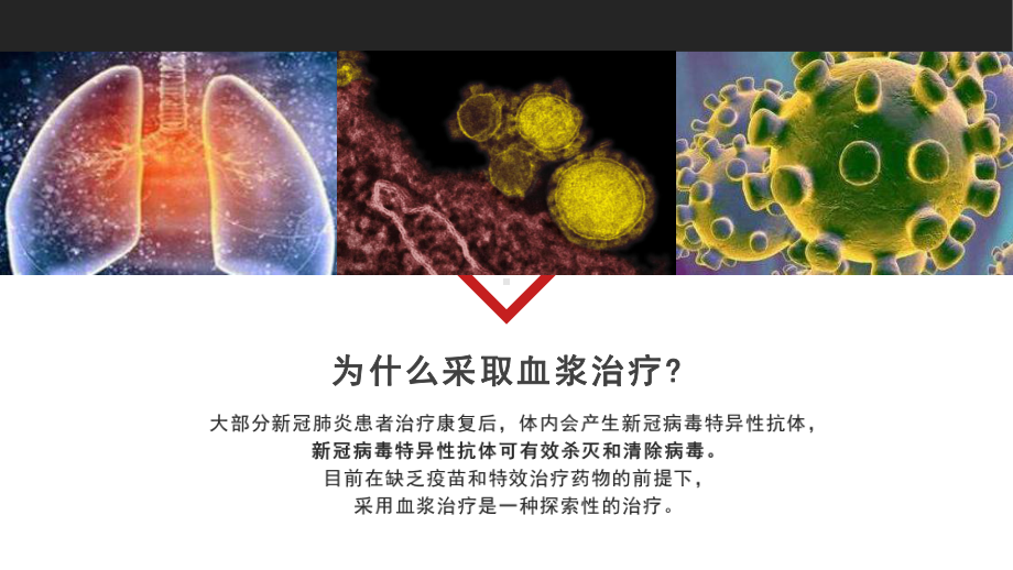 血浆治疗法介绍疫情防护知识图文PPT教学课件.pptx_第3页