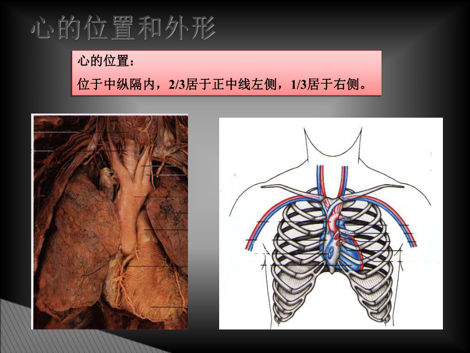 心脏瓣膜置换术后的护理知识分享课件.ppt_第3页