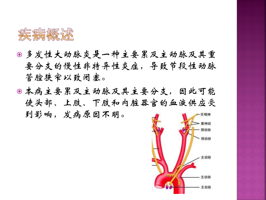 多发性大动脉炎PPT医学课件.pptx_第2页