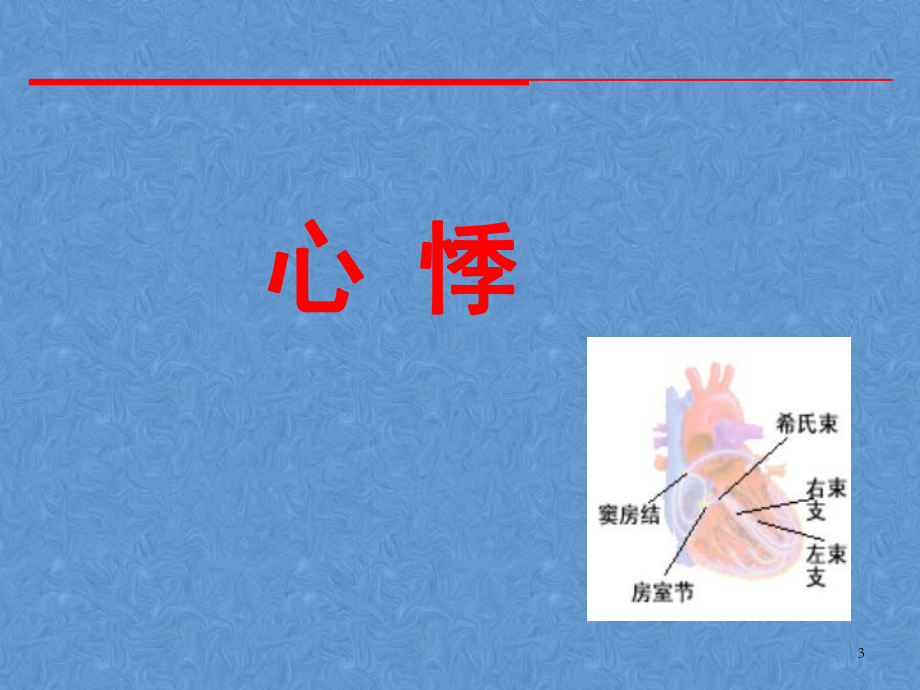 心系疾病课件.ppt_第3页