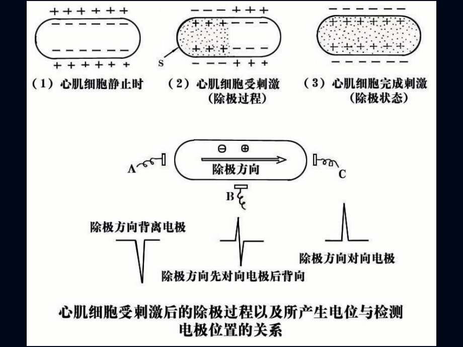 心电图诊断讲座课件.ppt_第3页