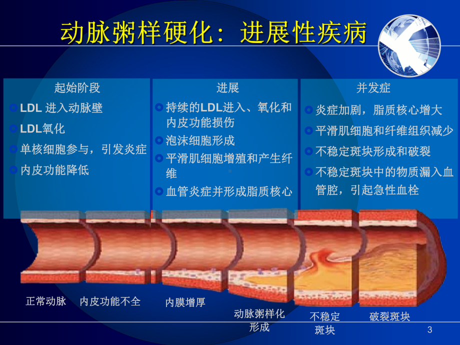 心肌梗死PPT幻灯片课件.ppt_第3页