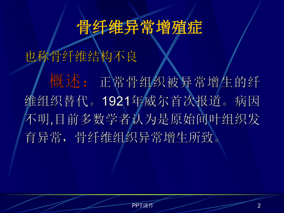 骨纤维异常增殖症的影像学诊断-ppt课件.ppt_第2页