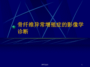 骨纤维异常增殖症的影像学诊断-ppt课件.ppt