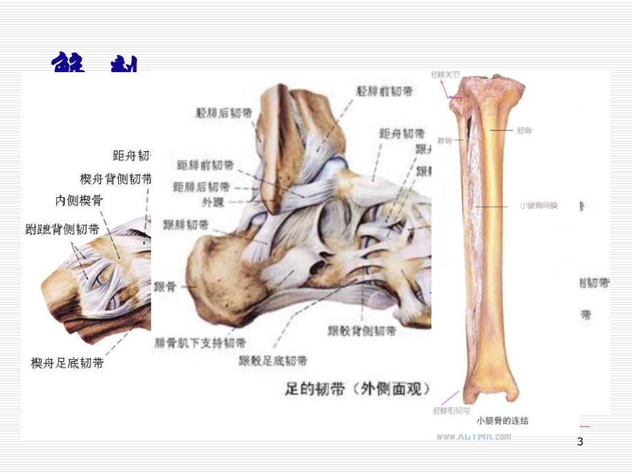 Pilon骨折-PPT课件.ppt_第3页