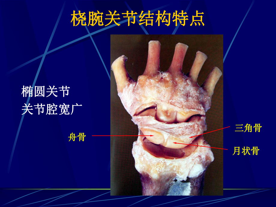 桡骨远端骨折概论课件.ppt_第3页