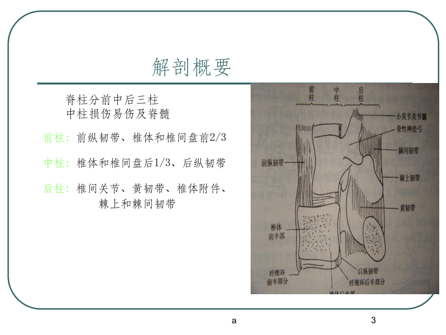 腰椎骨折课件.ppt_第3页