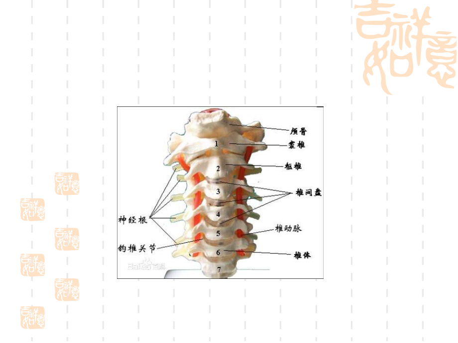 颈椎骨折病人的护理PPT课件.ppt_第3页