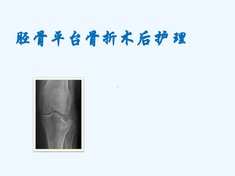 胫骨平台骨折护理课件.pptx_第1页