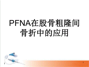 PFNA治疗股骨粗隆间骨折PPT幻灯课件.ppt