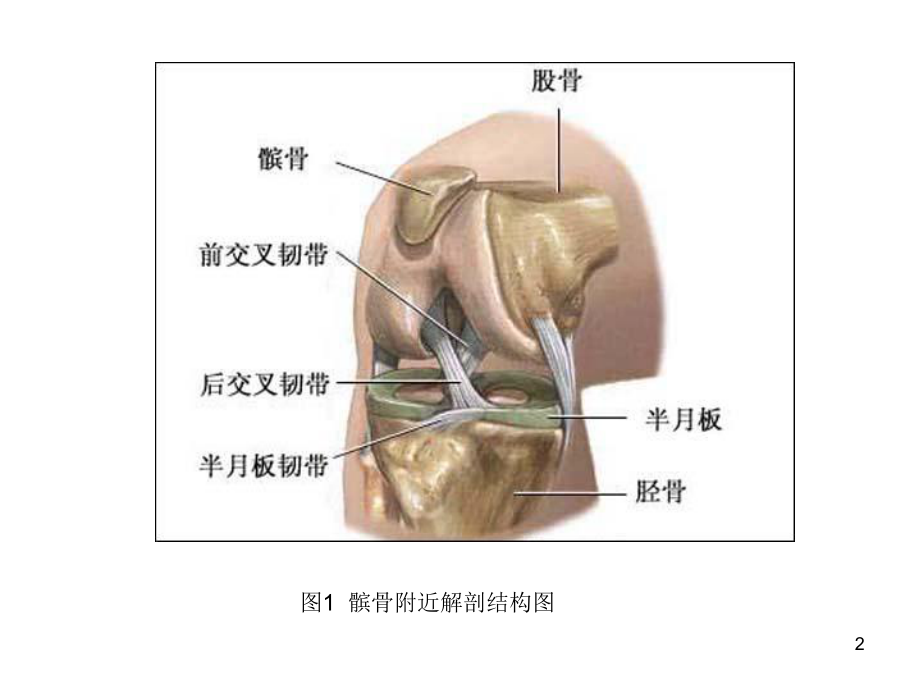 髌骨脱位病人的护理课件.ppt_第2页