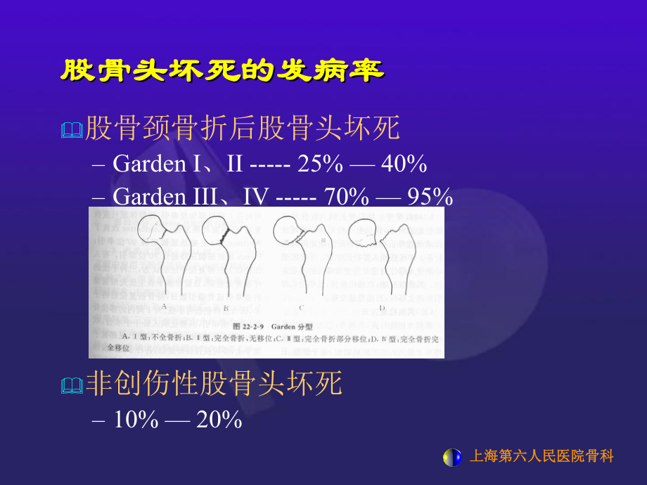 浅谈股骨头坏死课件.ppt_第3页