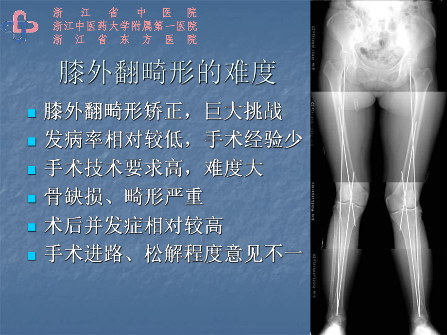 膝外翻畸形的全膝置换课件.ppt_第3页