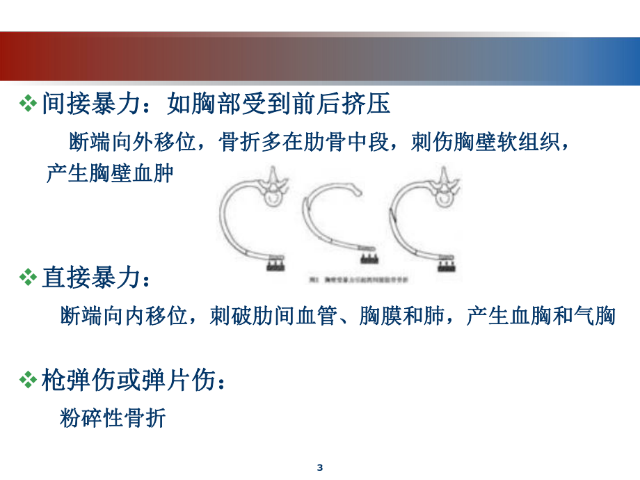 肋骨骨折PPT课件.ppt_第3页