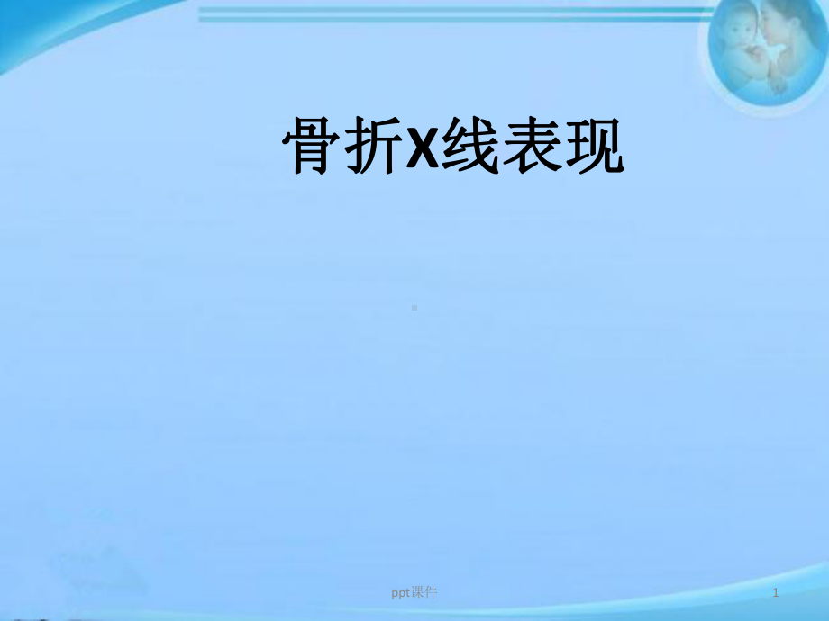 骨折X线表现-ppt课件.ppt_第1页