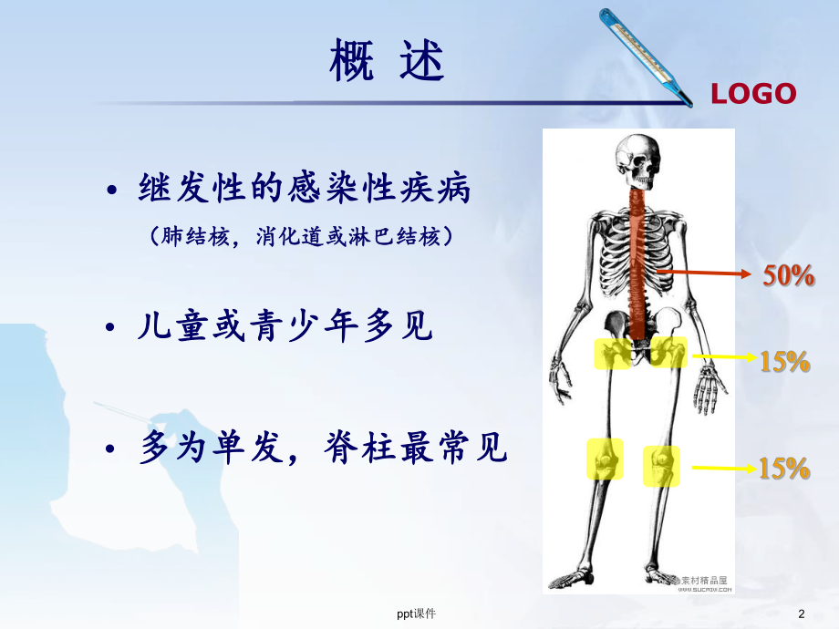 骨与关节结核-ppt课件.ppt_第2页