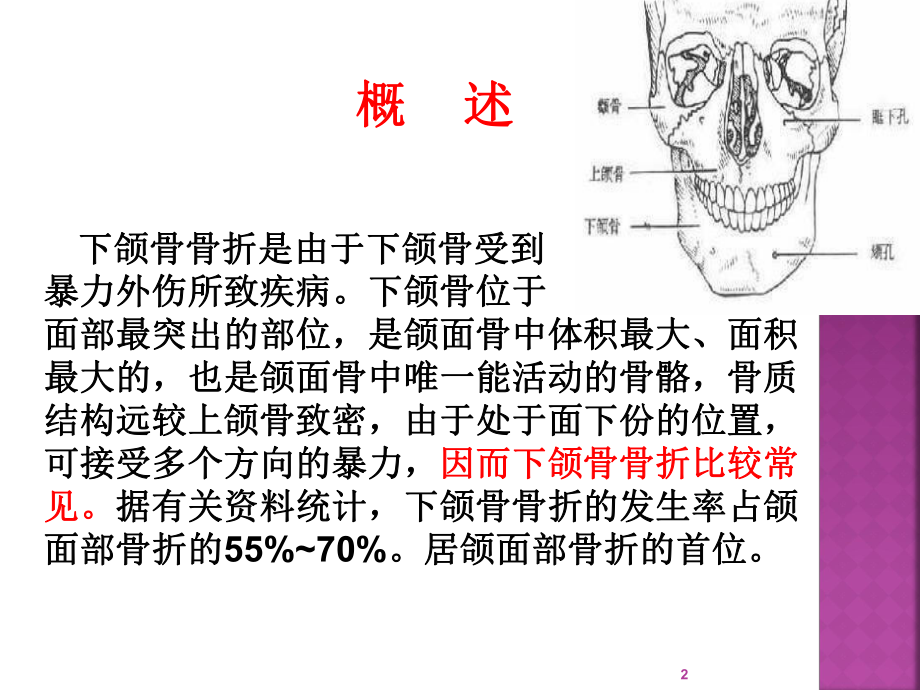 下颌骨骨折的护理查房PPT课件.ppt_第2页