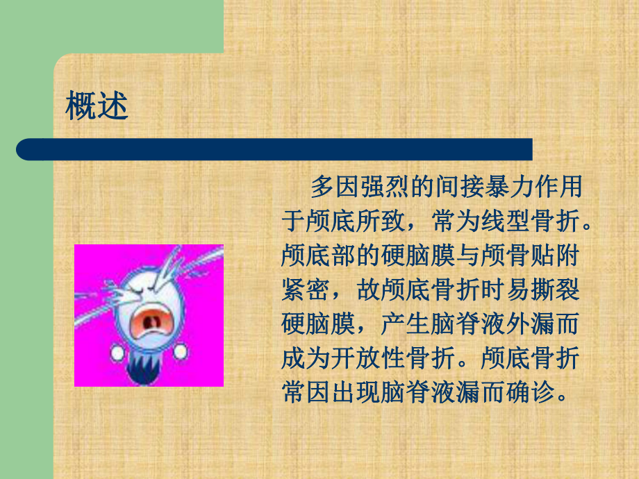 颅底骨折精编PPT课件.ppt_第2页