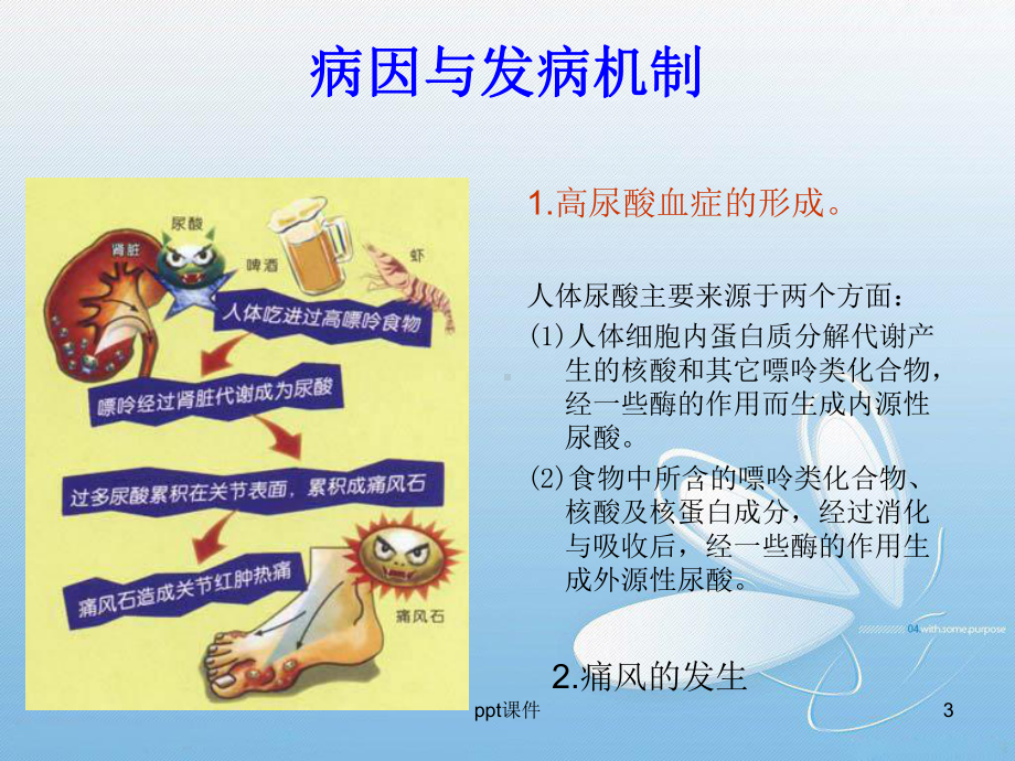 痛风性关节炎及护理（骨科）-ppt课件.ppt_第3页