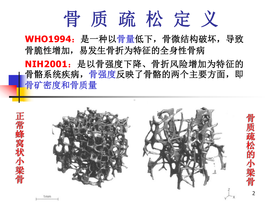 骨质疏松症的中西医结合治疗PPT课件.ppt_第2页