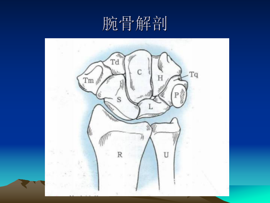 腕骨骨折脱位1课件.ppt_第2页