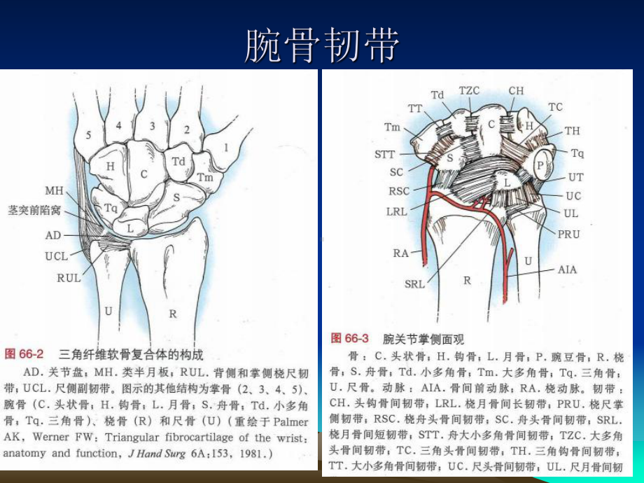 腕骨骨折脱位1课件.ppt_第3页