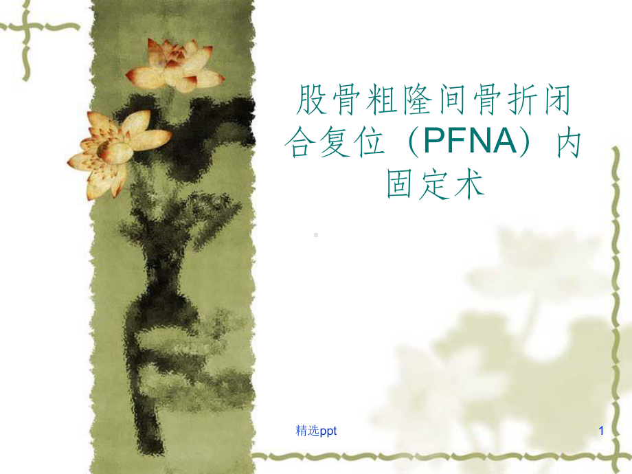 股骨粗隆间骨折手术配合(1)课件.ppt_第1页