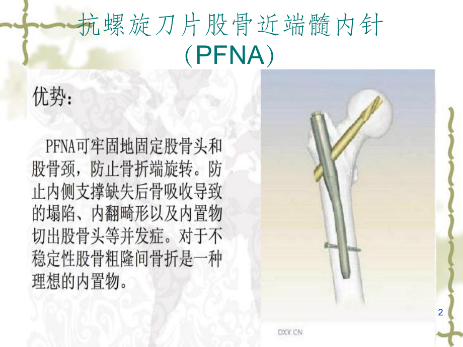 股骨粗隆间骨折手术配合(1)课件.ppt_第2页