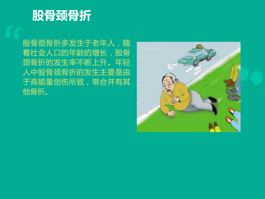 股骨颈骨折-ppt课件1.ppt_第2页