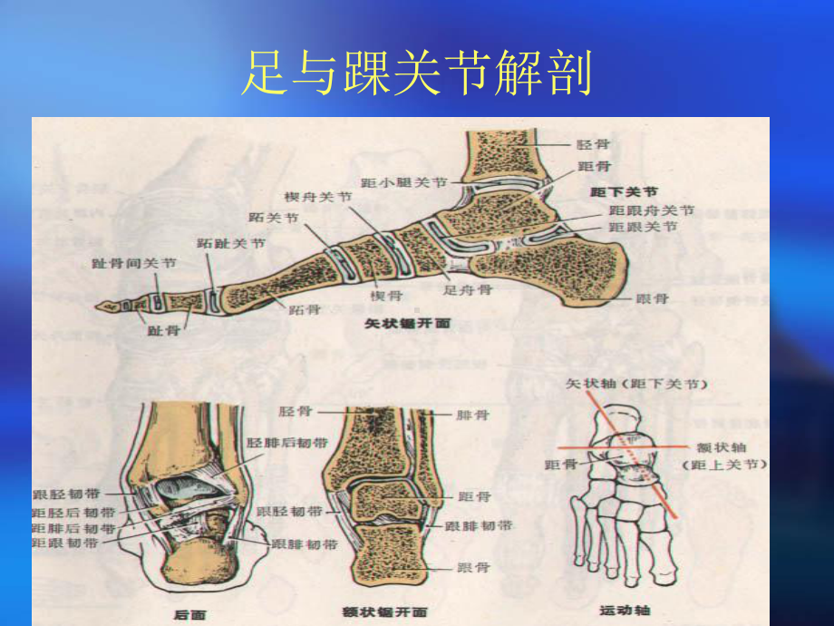 踝关节骨折病人的护理PPT课件1.ppt_第3页