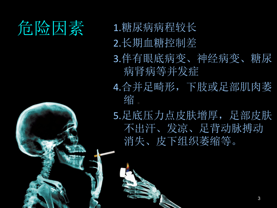 糖尿病性骨关节病PPT课件.ppt_第3页