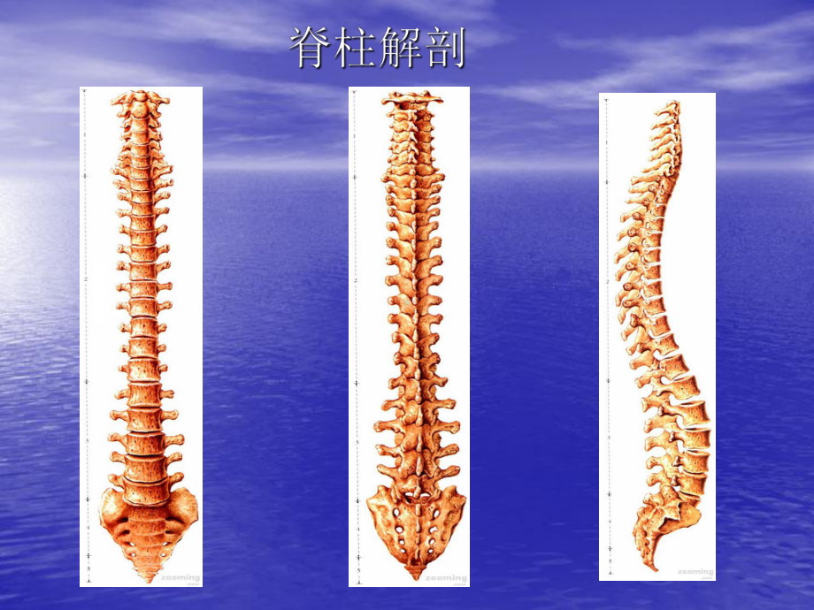 胸腰椎骨折病人的护理-课件.ppt_第3页