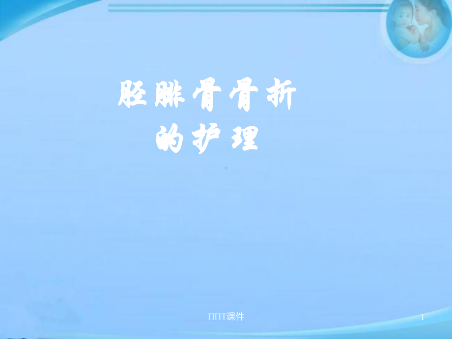 胫腓骨骨折的护理-ppt课件.ppt_第1页