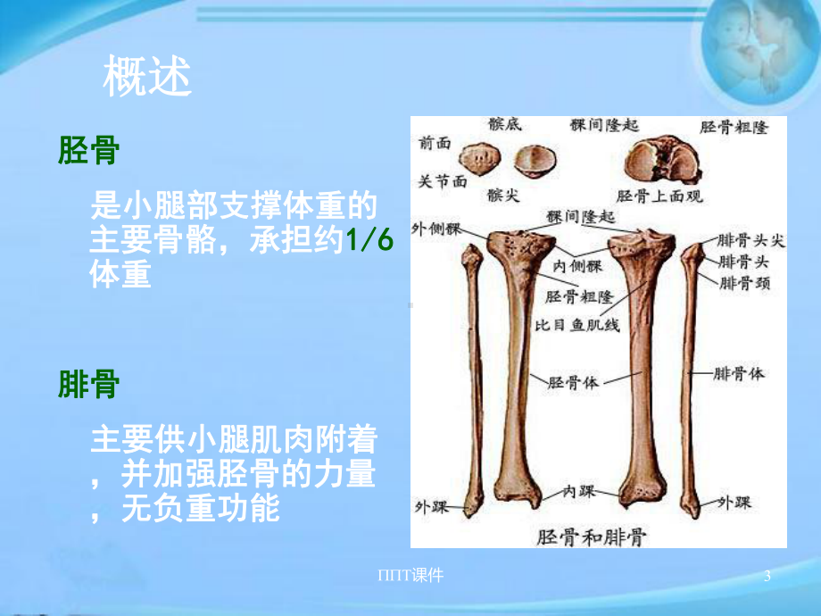 胫腓骨骨折的护理-ppt课件.ppt_第3页