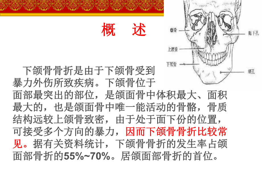 下颌骨骨折的护理查房-ppt课件.ppt_第2页