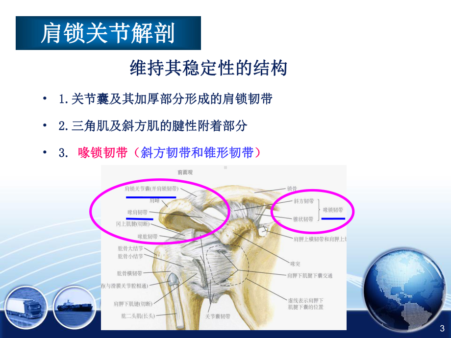 固定系统治疗肩锁关节脱位与锁骨远端骨折Tight课件.ppt_第3页