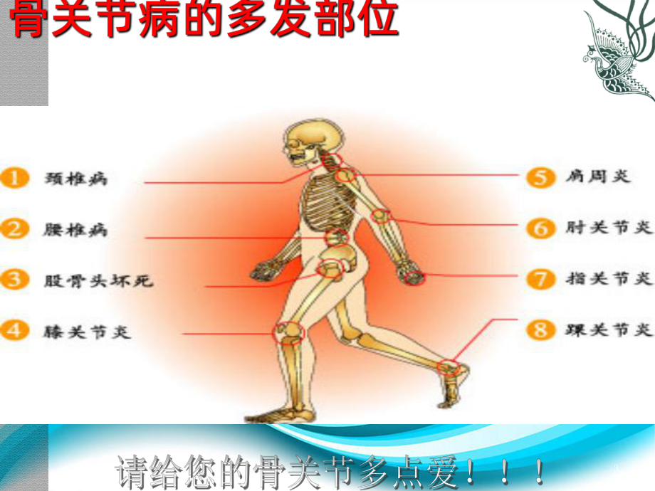 骨关节PPT课件.ppt_第3页